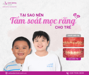 Câu chuyện khách hàng - Nguyễn Xuân Thịnh