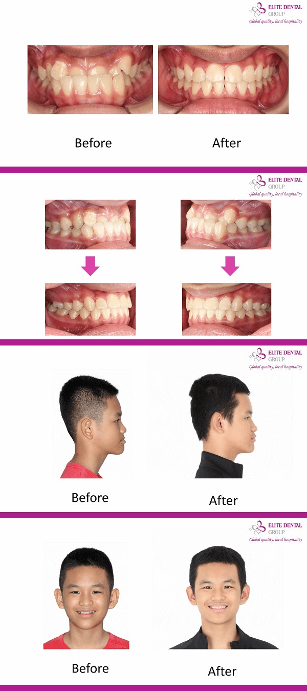 cau-chuyen-khach-hang-ho-nguyen-duy-anh