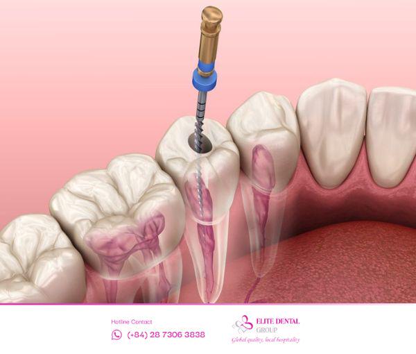 Sau khi lấy tuỷ bạn có thể gặp phải các cơn đau dai dẳng kéo dài