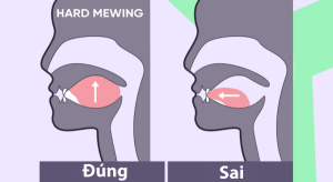 các lỗi sai khi tập mewing