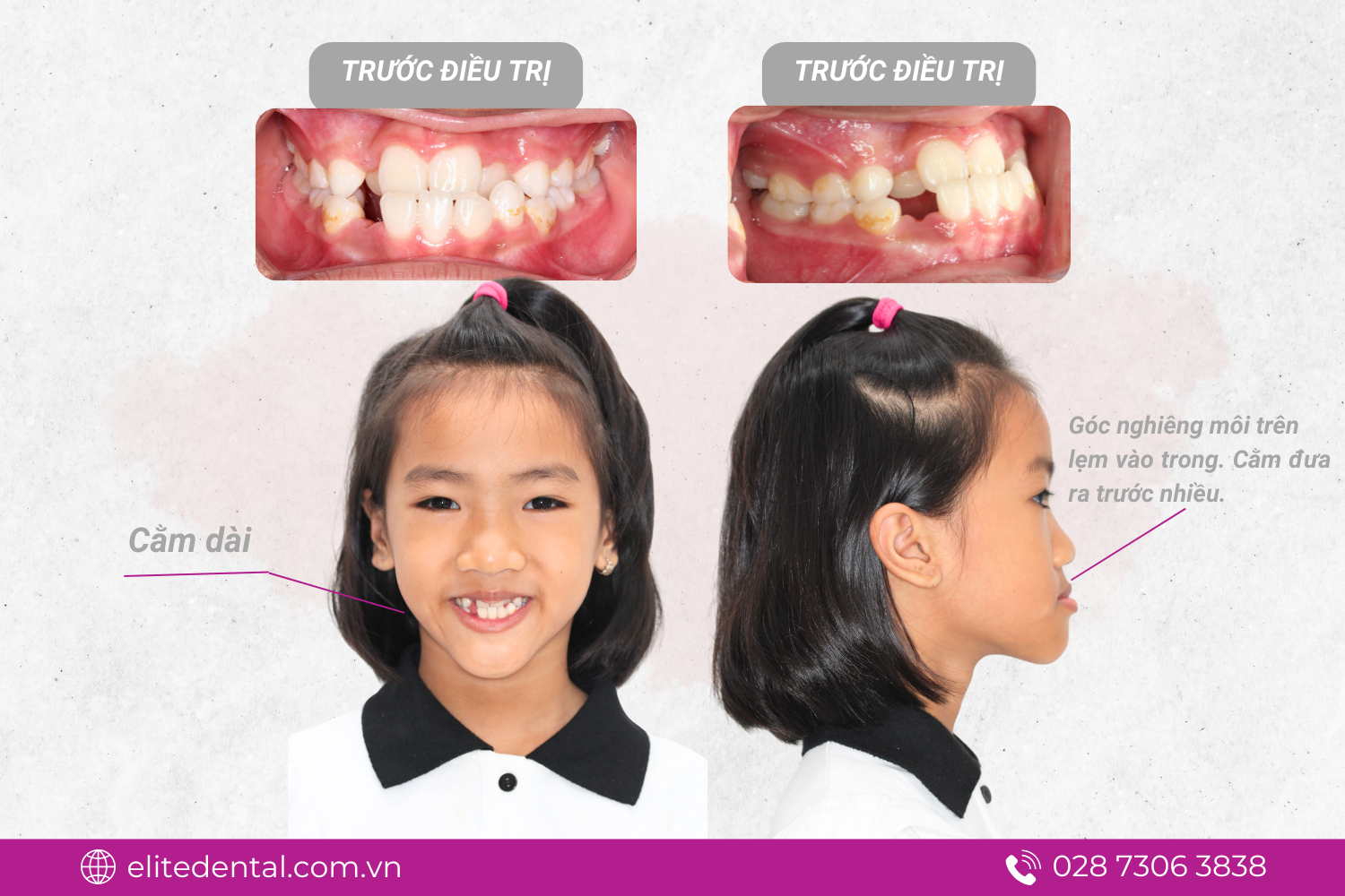 Chẩn đoán và kế hoạch điều trị ban đầu