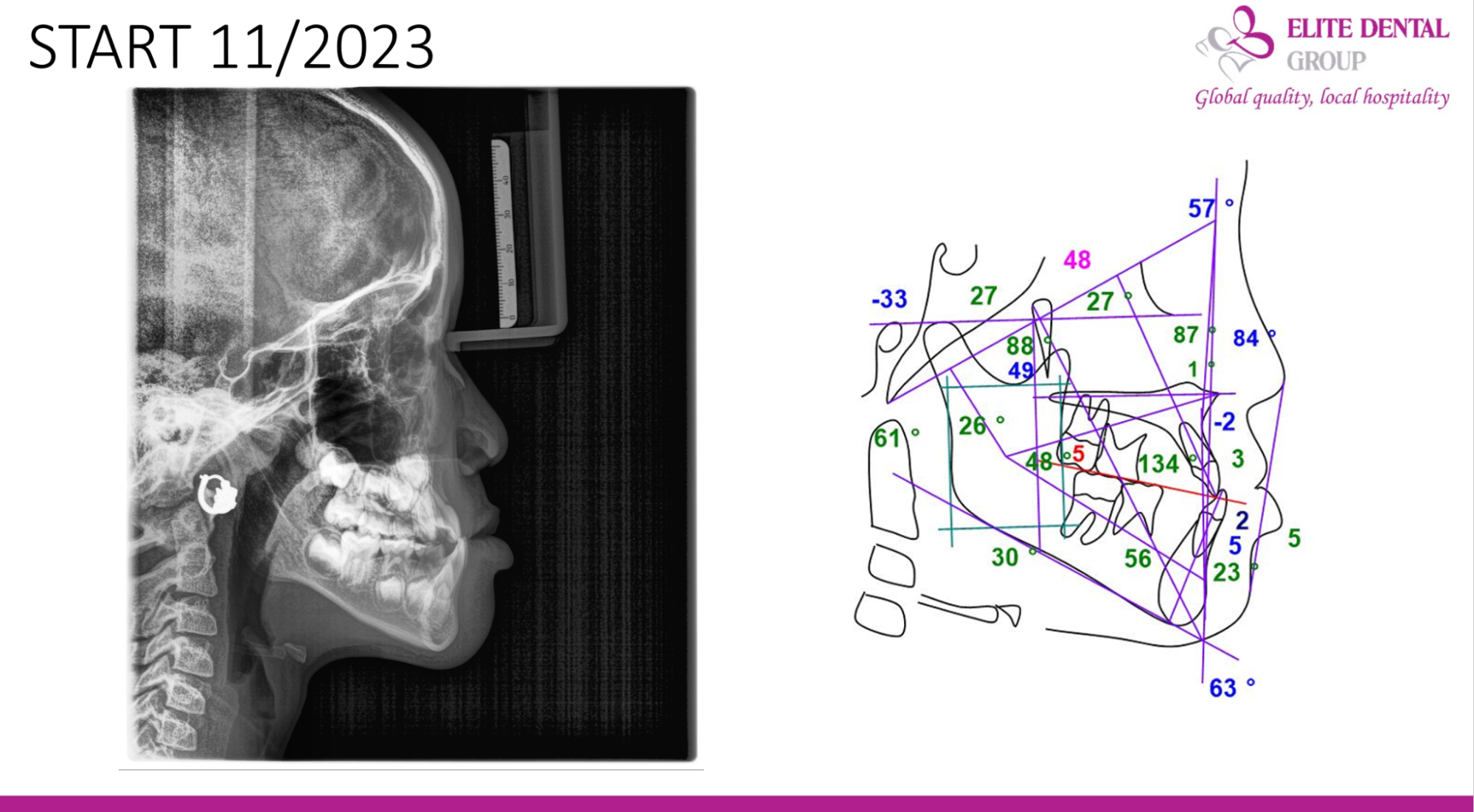 Bắt đầu vào tháng 11/2023