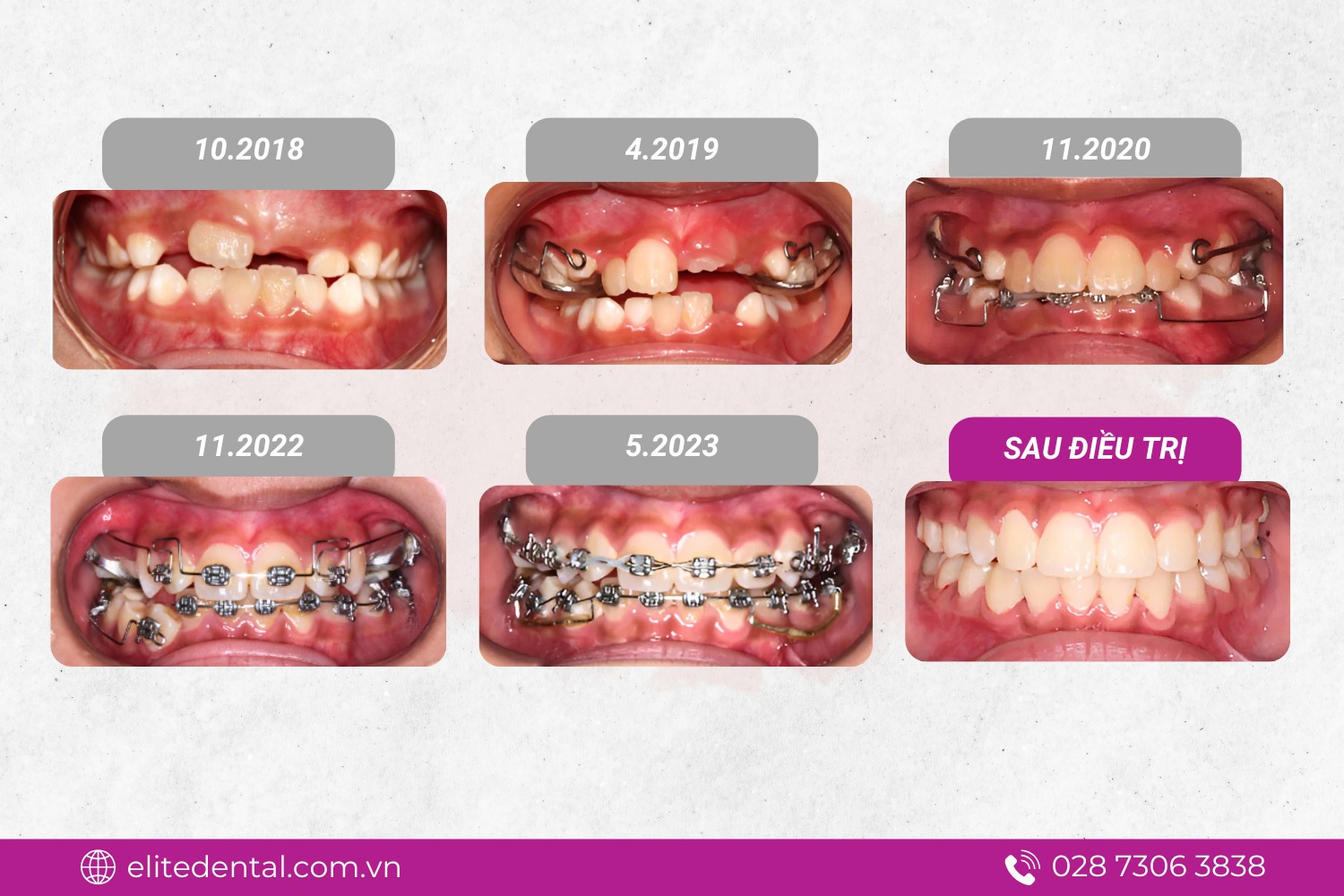 Phác đồ điều trị được xây dựng bài bản, cá nhân hóa giúp tối ưu kết quả