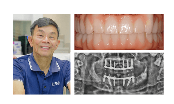 Kết quả cho hành trình đầu tư xứng đáng