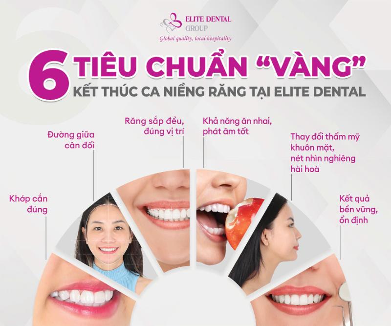 Các tiêu chí vàng khi kết thúc ca niềng tại Elite. 