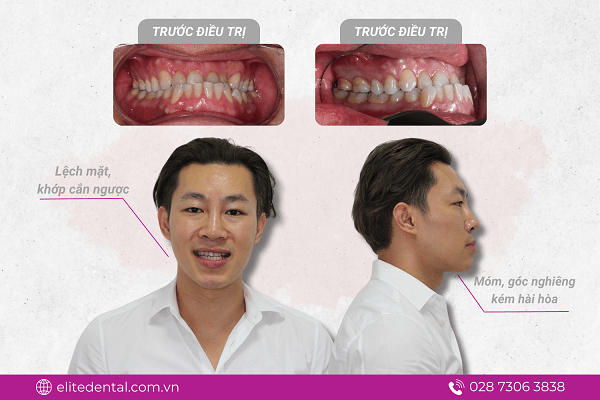 Elite Dental hướng đến chuyên môn và chuyên sâu trong quá trình điều trị