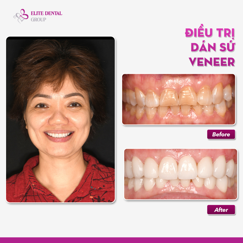 Lựa chọn nha khoa uy tín để đảm bảo hiệu quả sau điều trị