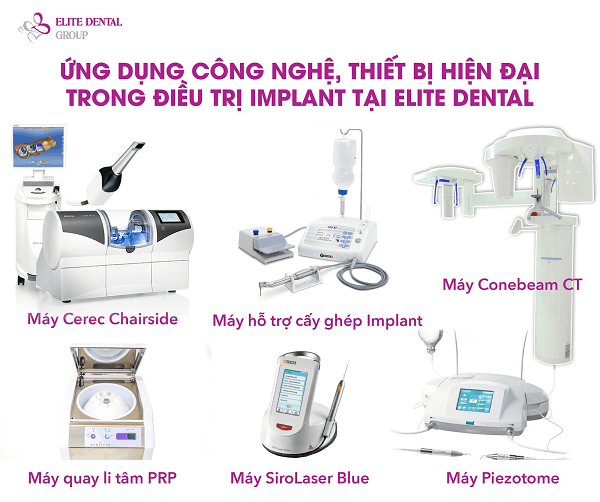 Elite Dental ứng dụng công nghệ vào lĩnh vực điều trị Implant