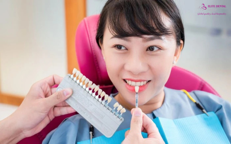 Dịch vụ nha khoa thẩm mỹ tại Elite Dental