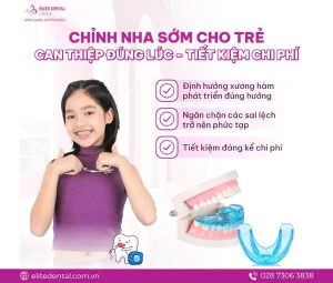Chỉnh nha sớm cho trẻ giúp tối ưu chi phí