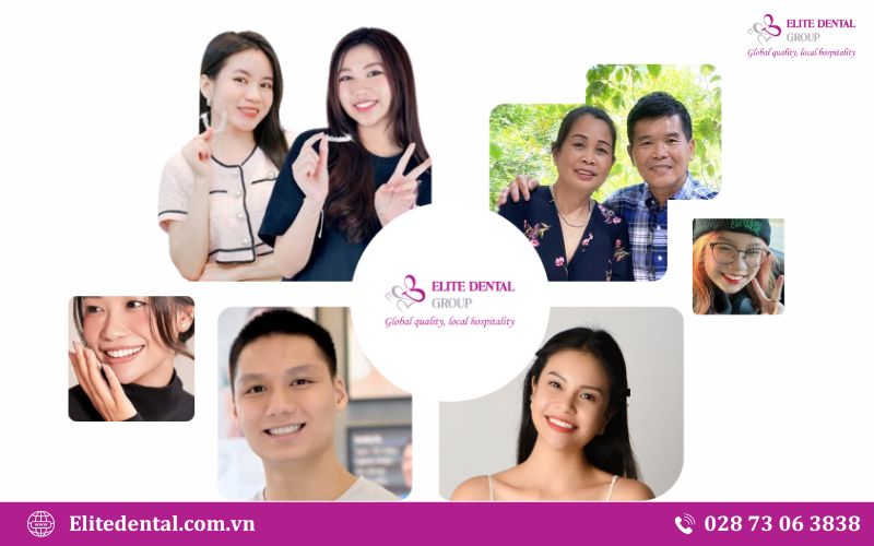 Kiến tạo nụ cười và vẻ ngoài với dịch vụ nha khoa thẩm mỹ tại Elite Dental