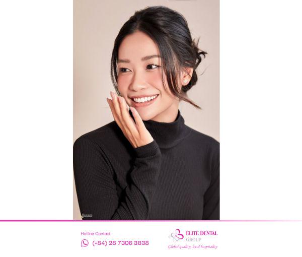 Khách hàng chia sẻ kinh nghiệm niềng răng.