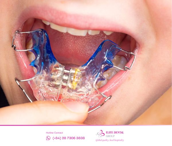 Nong hàm cần được bác sĩ theo dõi và lên liệu trình để đảm bảo kết quả