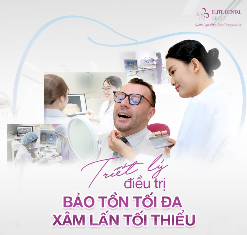 Lựa chọn địa chỉ trồng răng Implant chất lượng cao