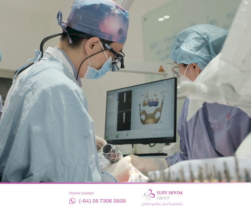 Mật độ xương hàm tốt giúp cấy Implant trực tiếp, trường hợp tiêu xương nặng cần nâng xoang ghép xương tăng chi phí