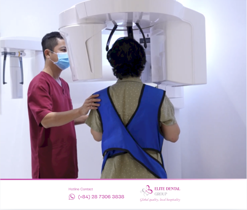 Quy trình Implant 6 bước tại Elite Dental khởi đầu bằng khám tổng quát và chụp CBCT 3D giúp đánh giá chính xác mật độ xương hàm