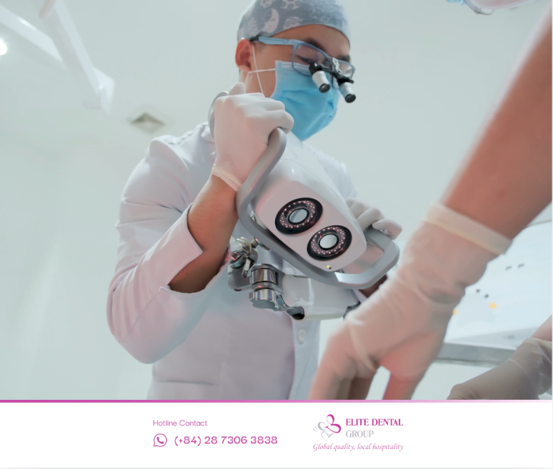 Gắn cố định răng sứ hoàn thiện lên 4 trụ Implant bằng công nghệ lấy dấu PIC và chế tác CAD/CAM hiện đại