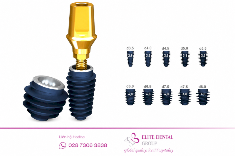 Chất lượng trụ cũng ảnh hưởng đến giá thành trồng răng Implant Hàn Quốc