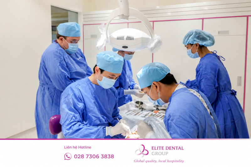 Các chi phí khác có thể phát sinh khi trồng Implant