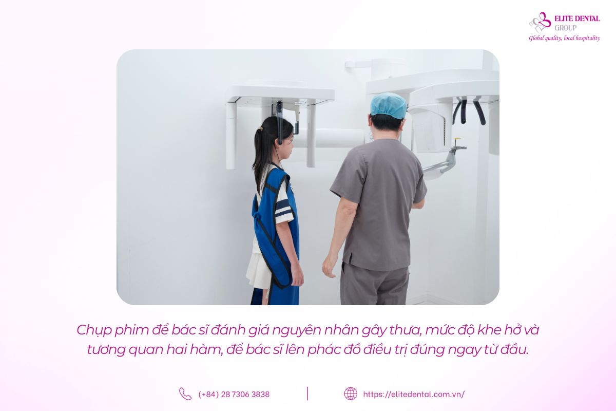 bác sĩ chụp phim khảo sát tình trạng răng, xương hàm
