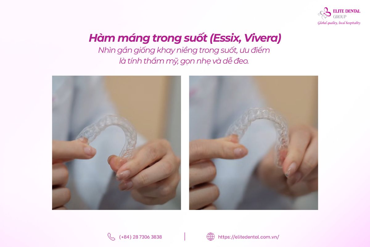 hàm máng trong suốt