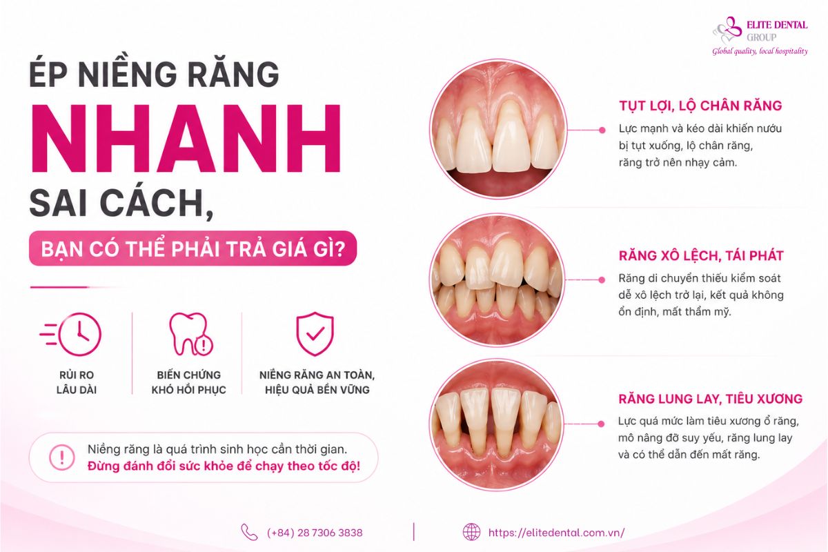niềng răng nhanh có an toàn không