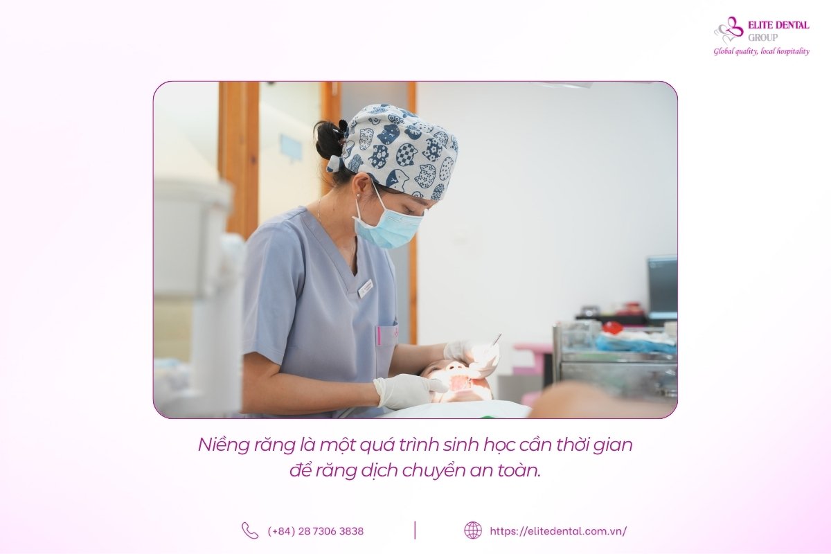niềng răng nhanh không đảm bảo thời gian để răng dịch chuyển an toàn