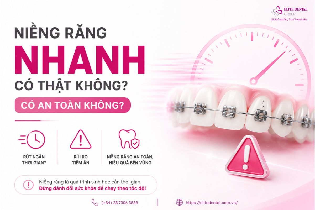 niềng răng nhanh
