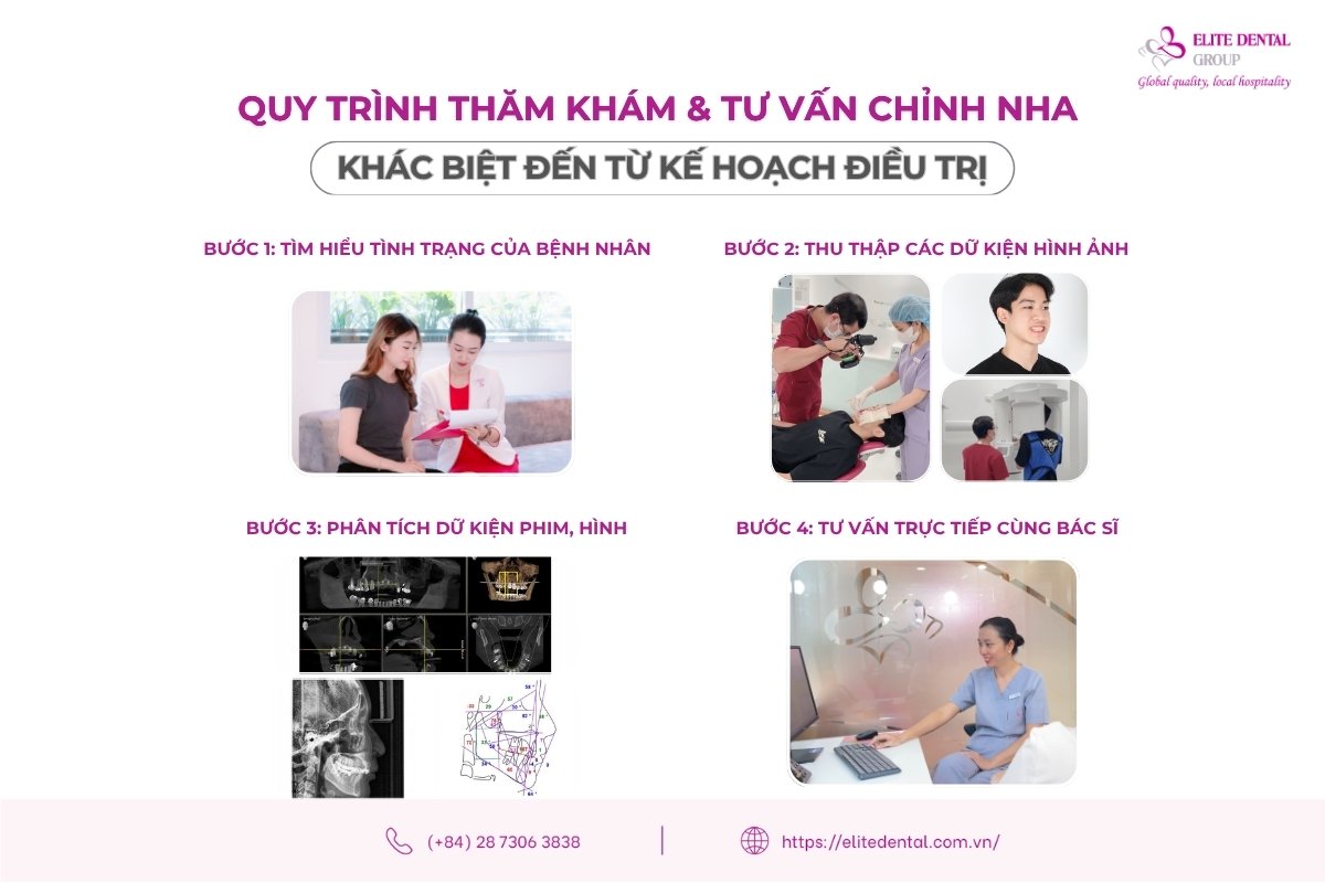 quy trình niềng răng tại nha khoa elite dental
