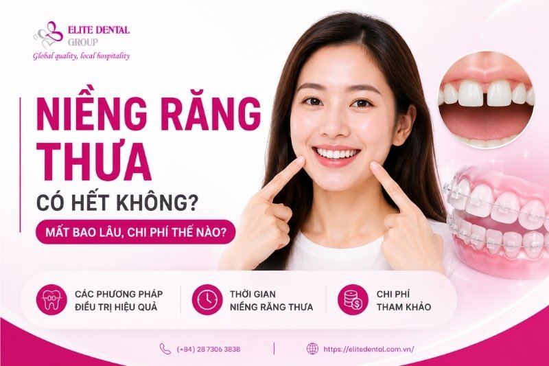 niềng răng thưa