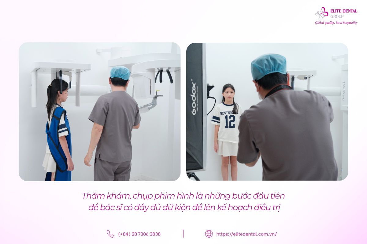 thăm khám chụp phim trước khi niềng răng