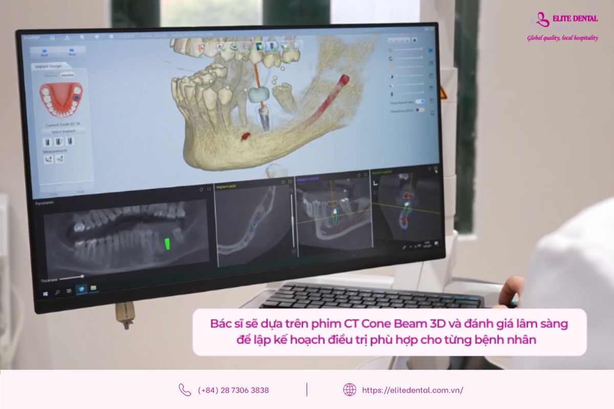 đánh giá lâm sàng và lập kế hoạch điều trị