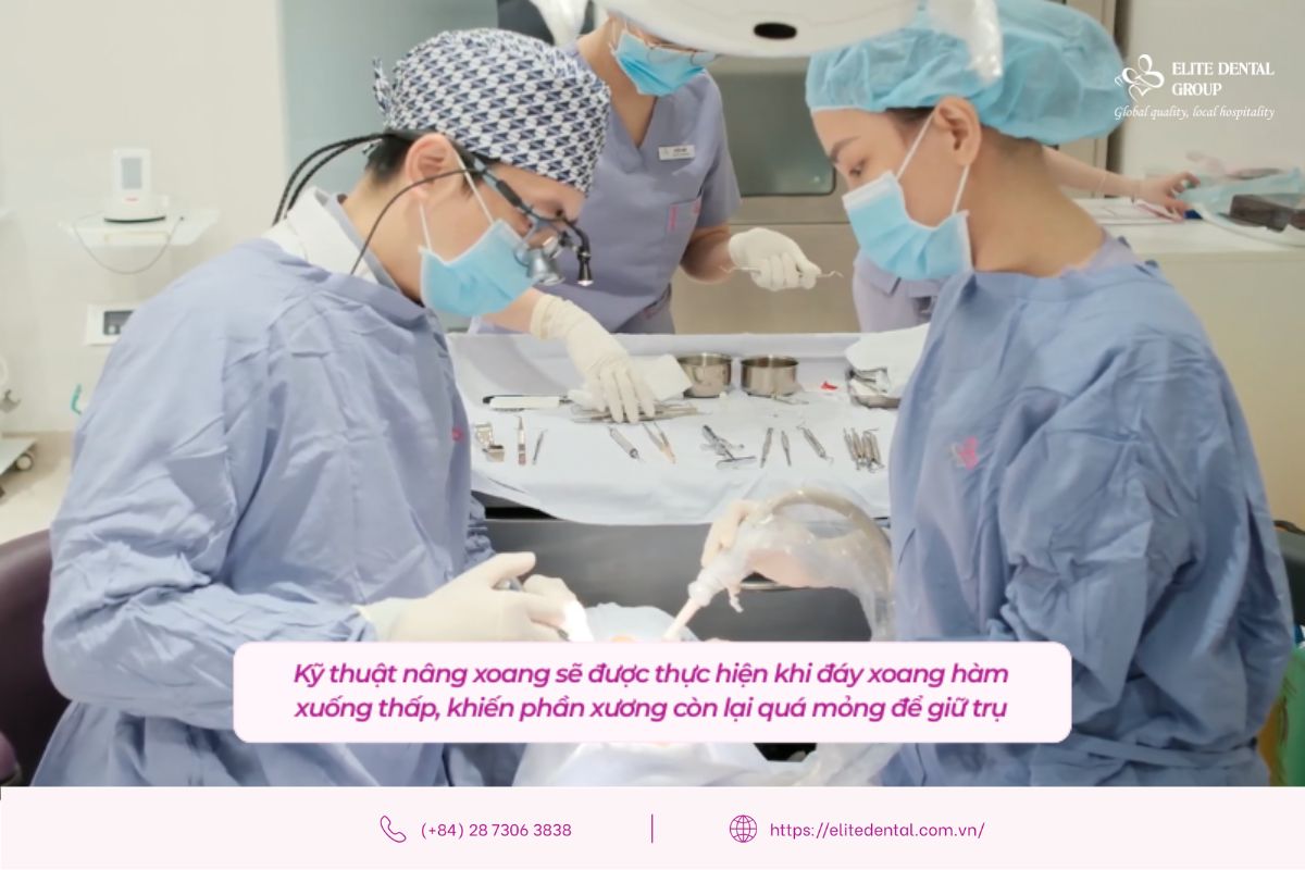 bác sĩ elite dental thực hiện kỹ thuật nâng xoang