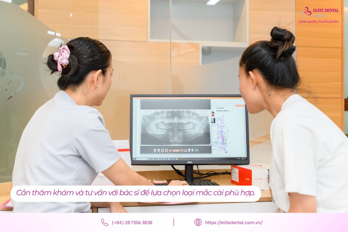 bác sĩ elite dental tư vấn chọn loại mắc cài