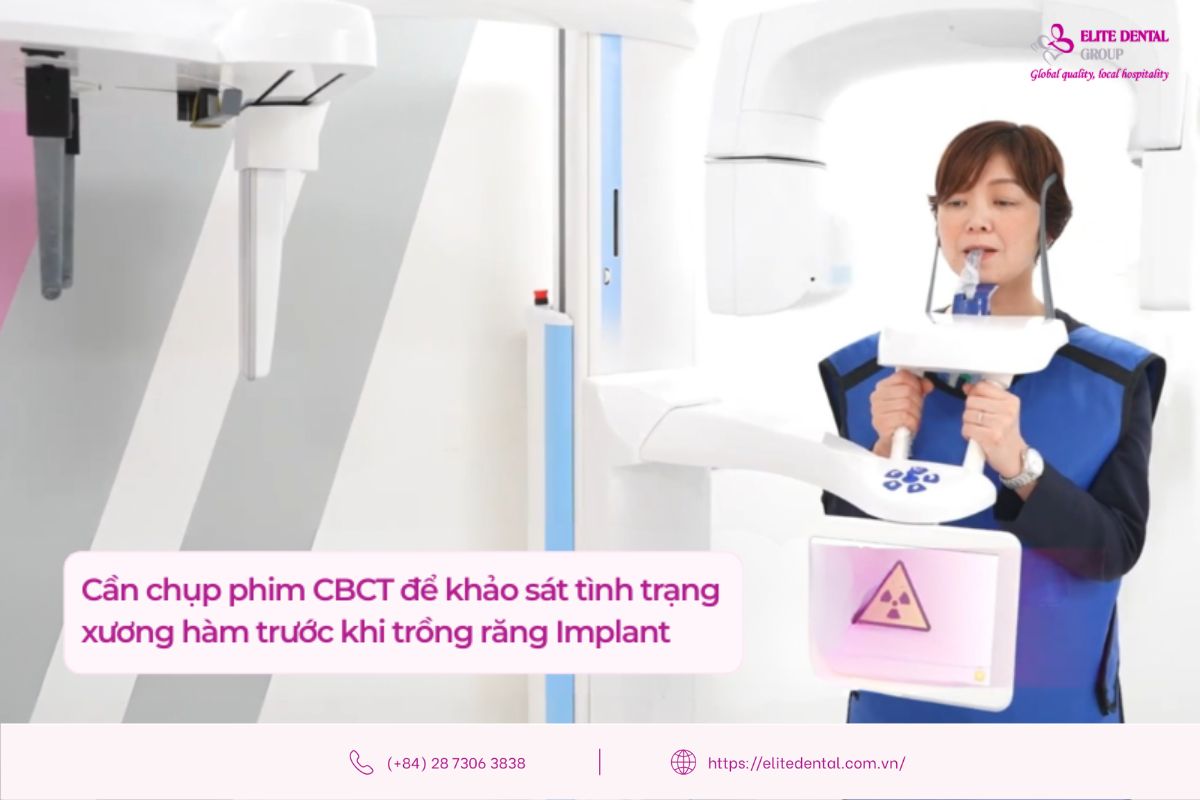 chụp phim để đánh giá tình trạng xương hàm