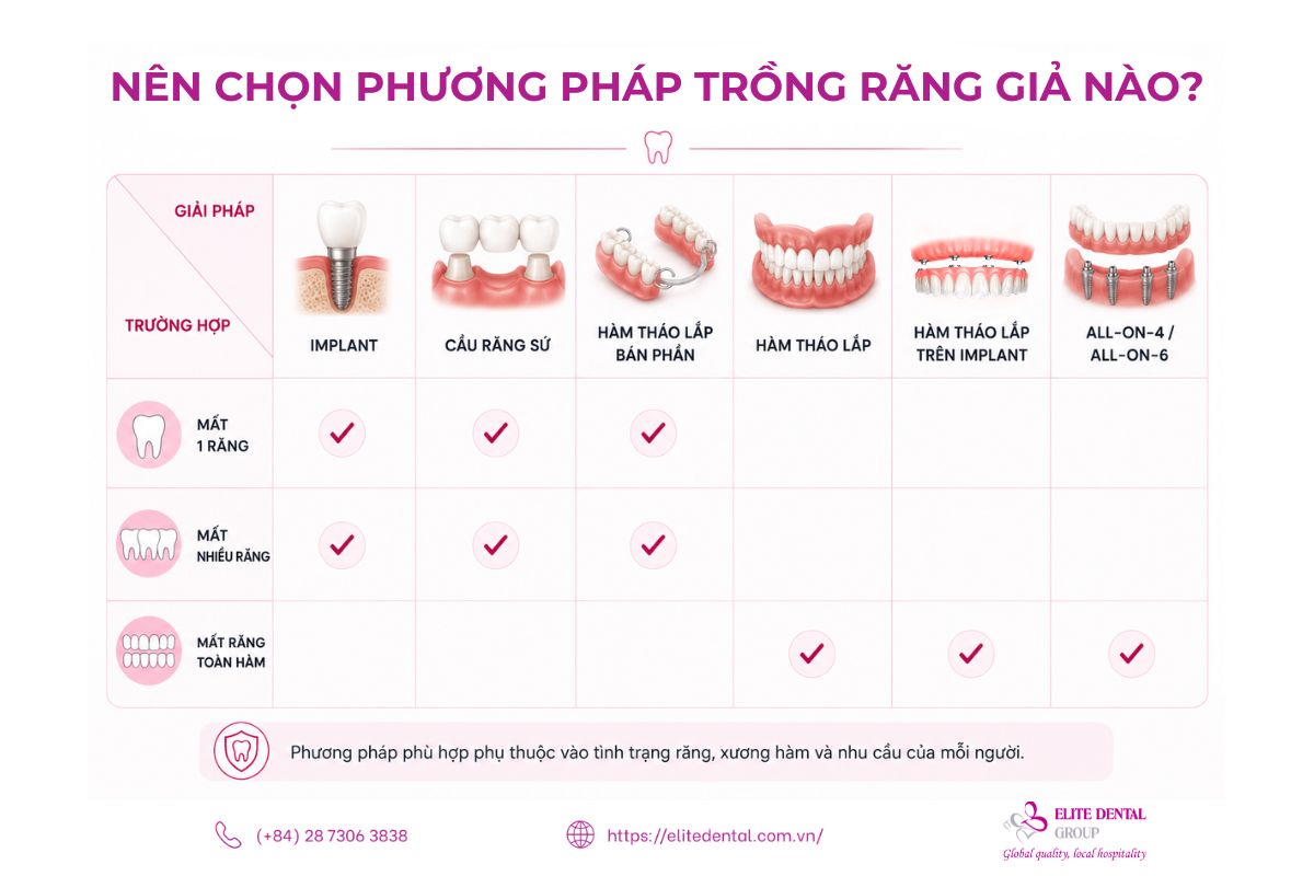 nên chọn phương pháp làm răng giả nào