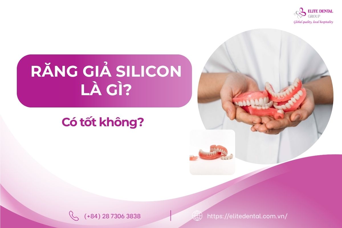 răng giả silicon là gì
