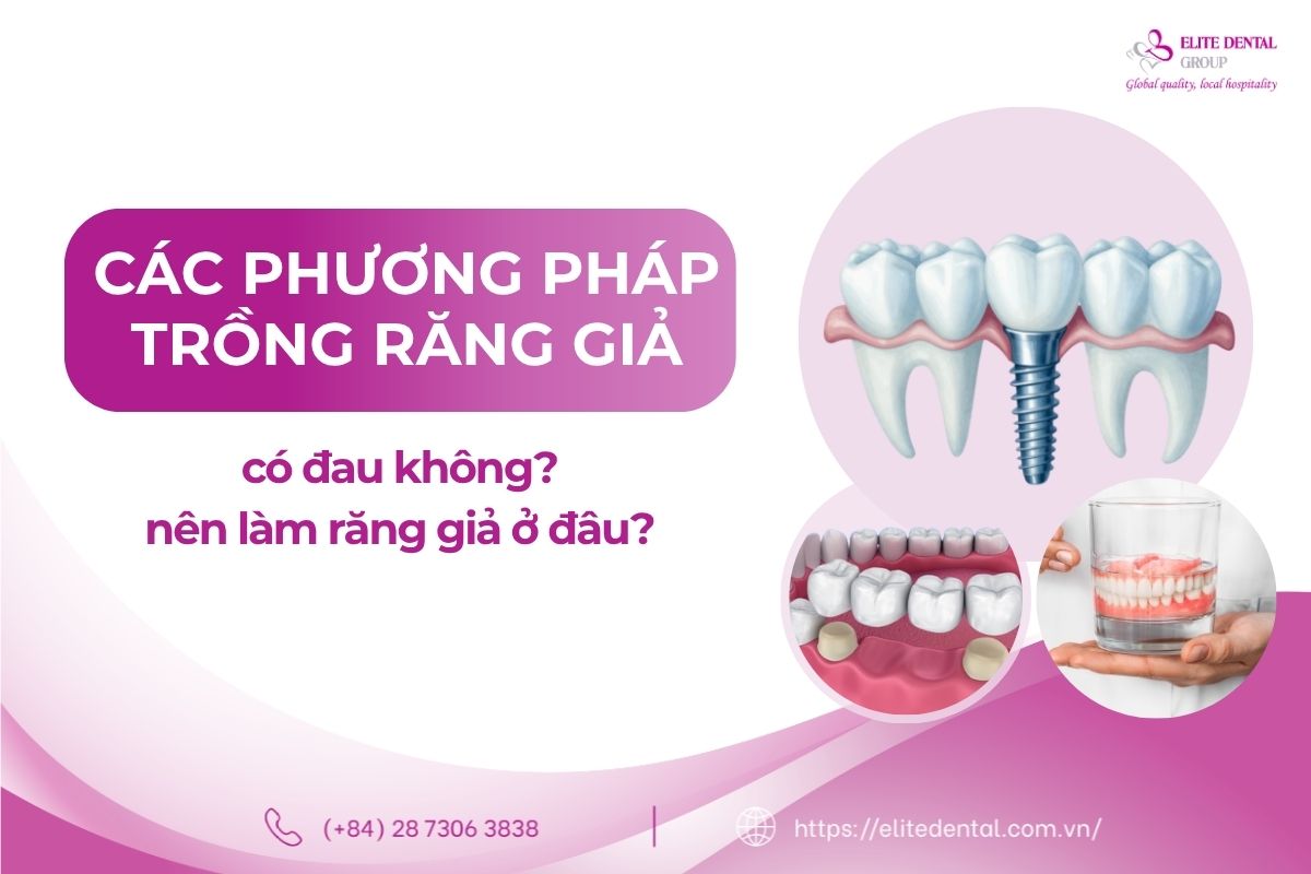 trồng răng giả