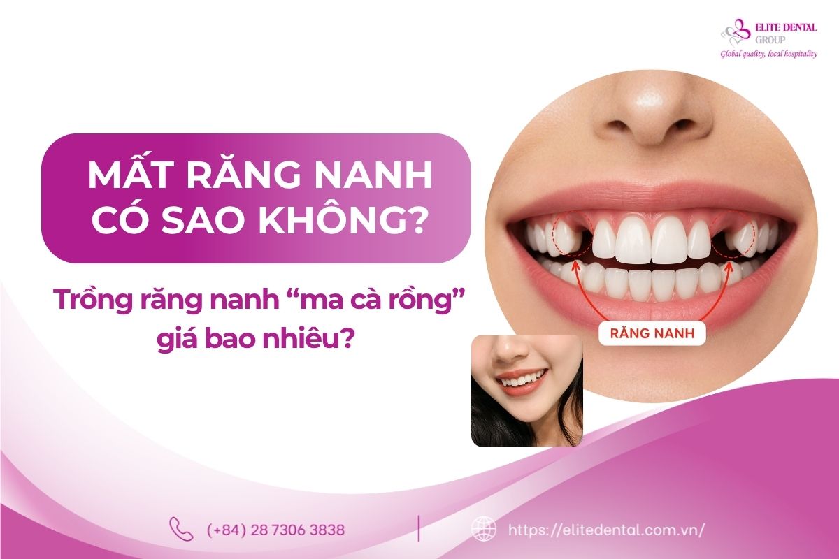 trồng răng nanh