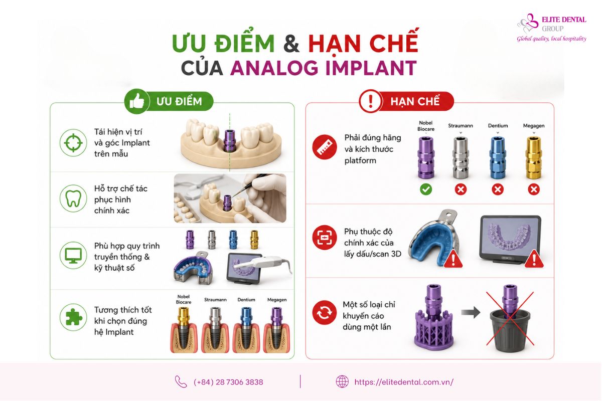 ưu và nhược điểm của analog implant