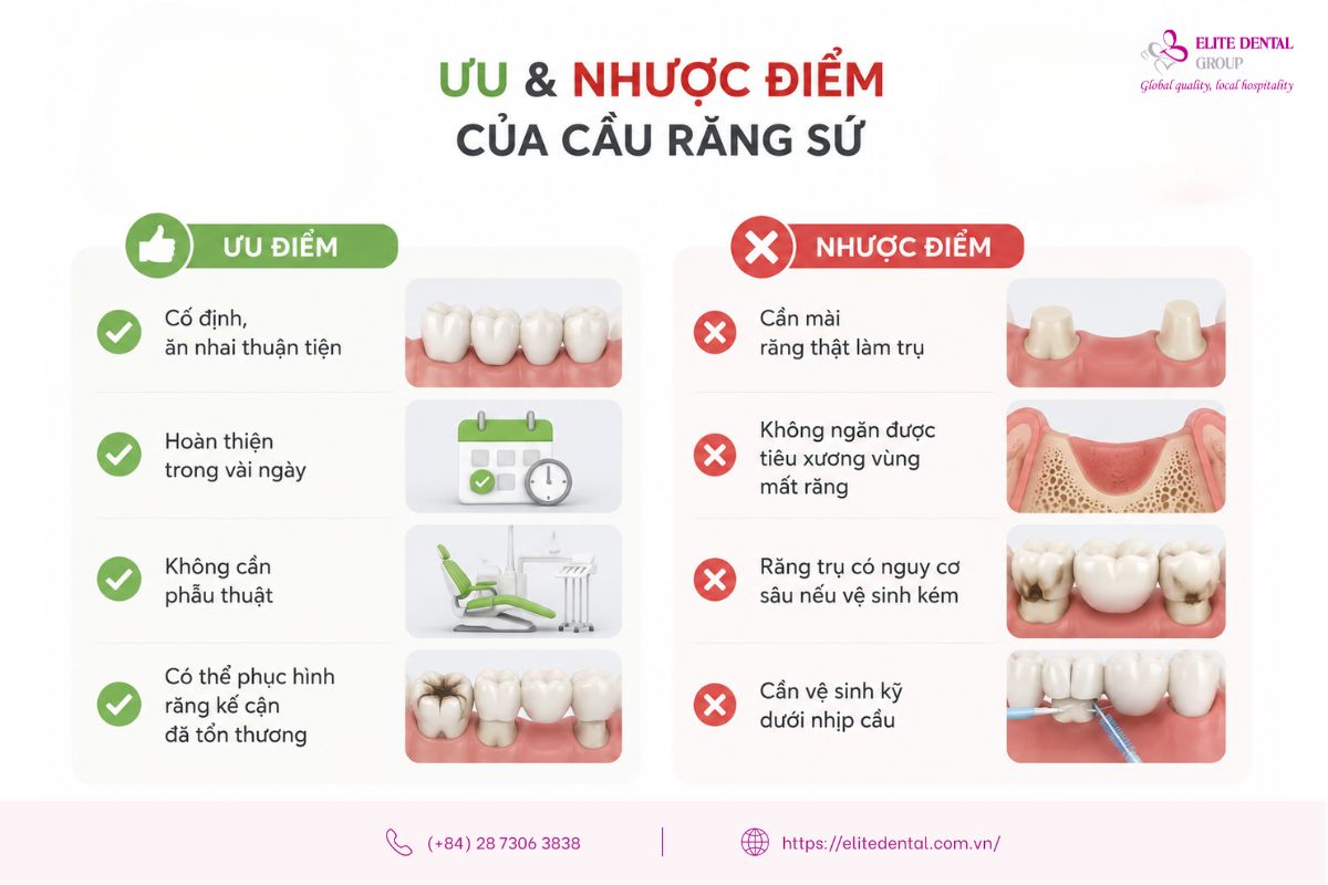 ưu và nhược điểm của cầu răng sứ