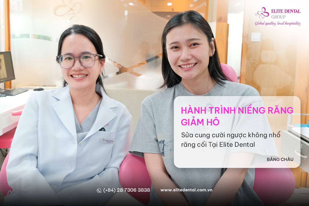băng châu khách hàng niềng răng hô elite dental