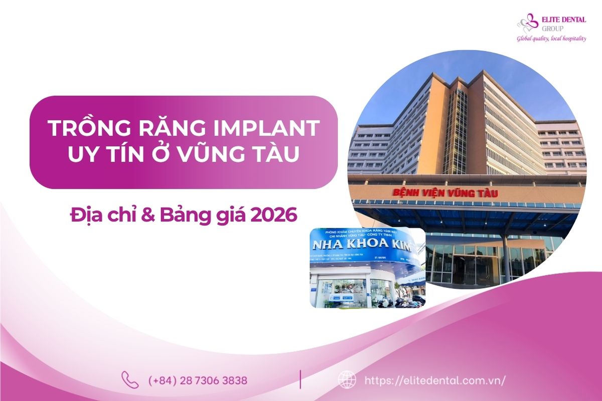 địa chỉ trồng răng uy tín ở vũng tàu