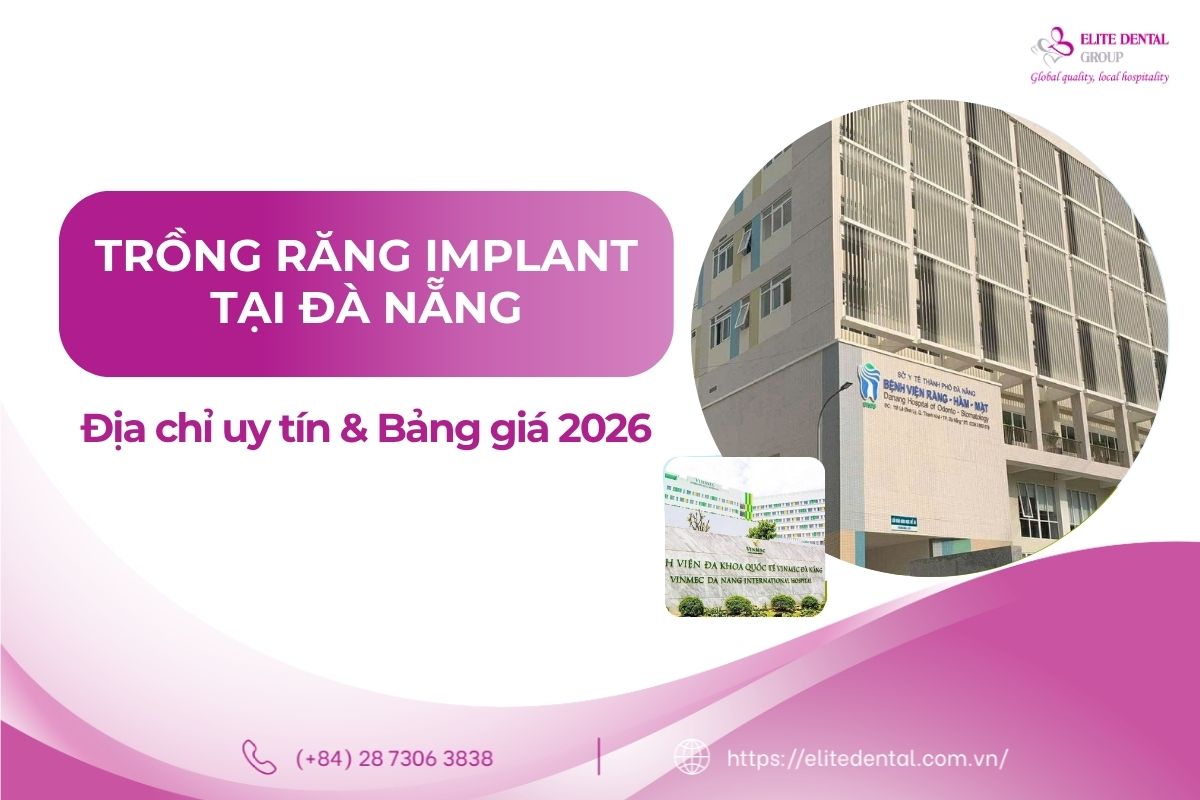 trồng răng implant tại đà nẵng